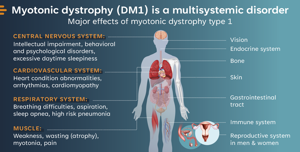 A Two Pronged Approach To Myotonic Dystrophy Type 1