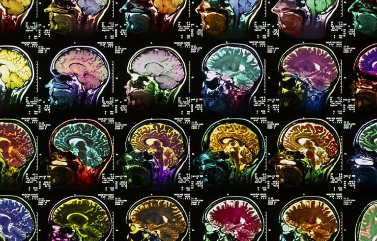 Collage of coloured sagittal MRI scans of the human brain.