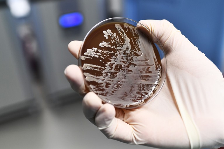Bacteria growing on an agar plate