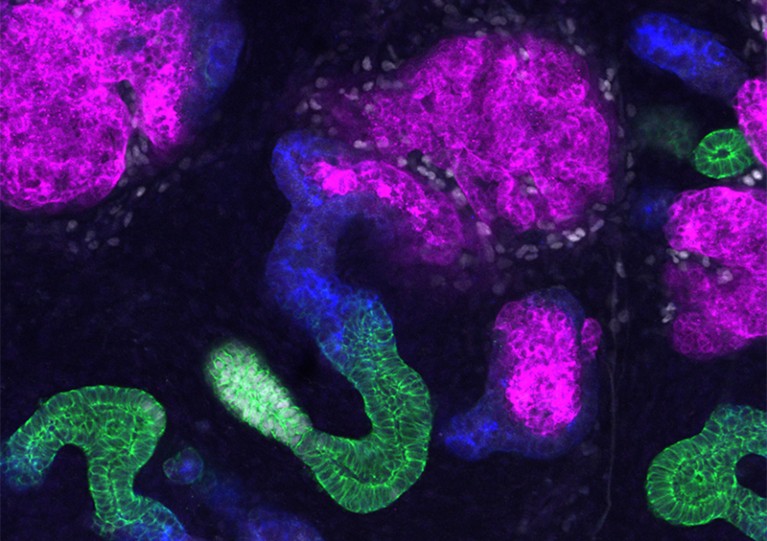 Image of organoids showing patterned nephrons