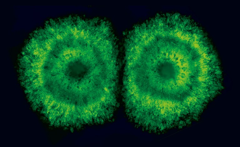 Neuron precursor cells derived from human pluripotent stem cells