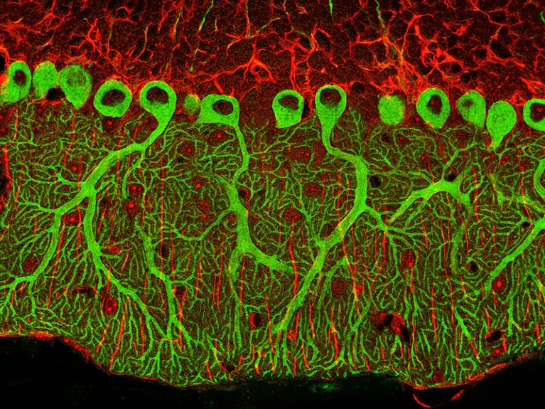 Cerebellum tissue. 2-photon fluorescent micrograph of a section through the cerebellum of the brain.