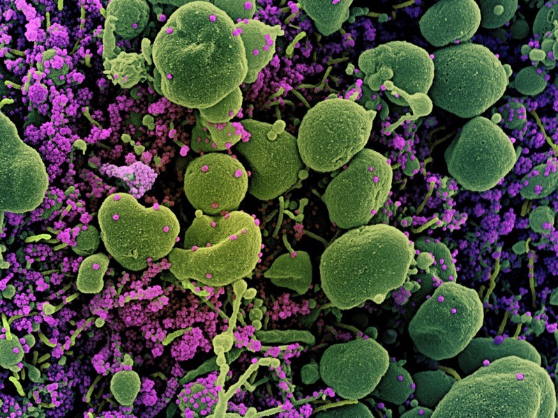Scanning electron microscope image showing small purple spheres covering green shapes.