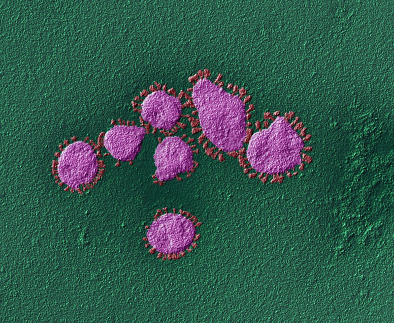 Coloured scanning electron micrograph of a cluster of coronavirus particles