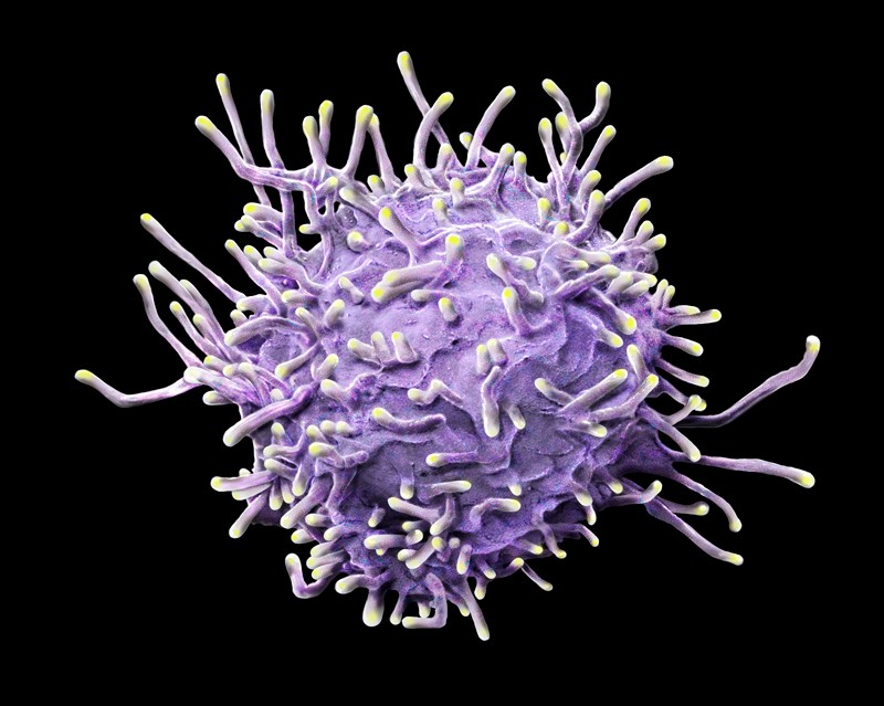 Coloured scanning electron micrograph of an activated T lymphocyte
