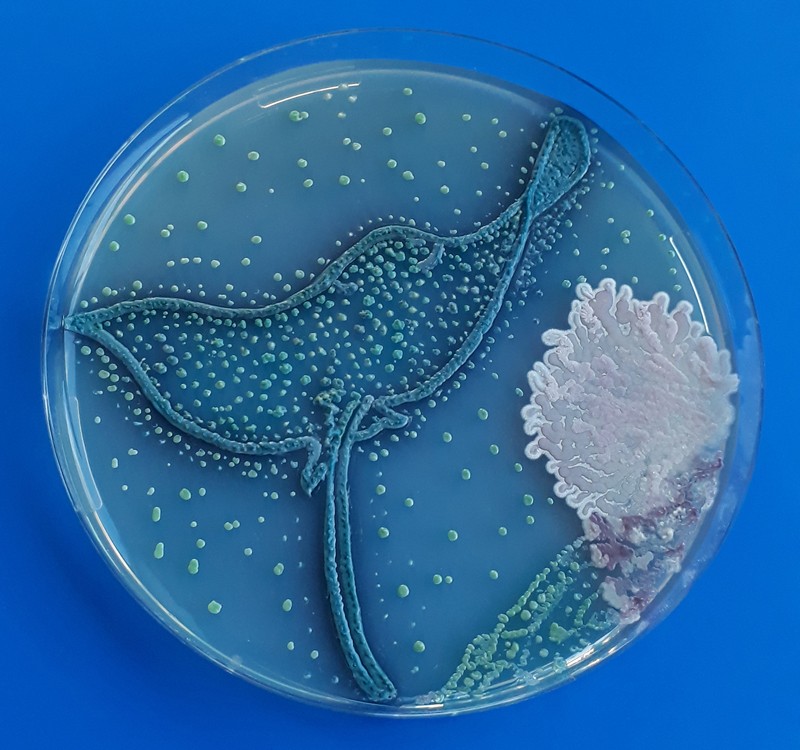 Microbe(s) grown on agar plates. Third place of the American Society for Microbiology’s art contest.