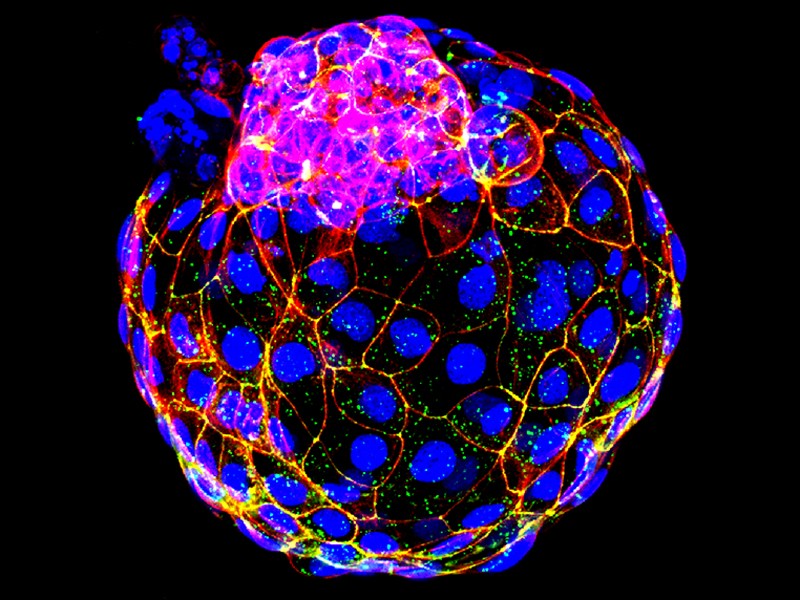 Immunofluorescence co-staining images of ZO1 (Zonula Occludent-1, green) and phalloidin (red) in a human blastoid.