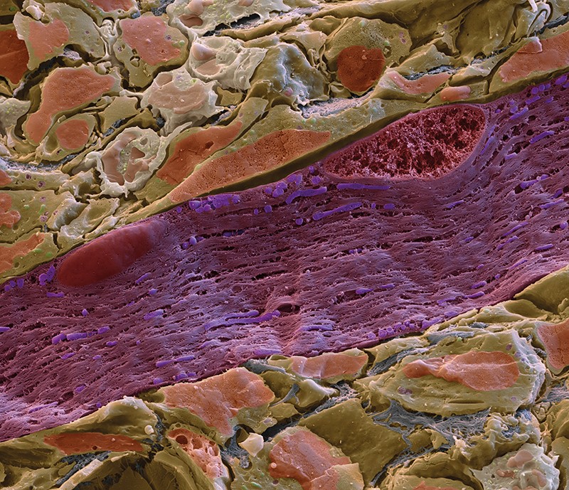 Coloured scanning electron micrograph of a section through muscle tissue, showing the interior of a mitochondrion stained purple