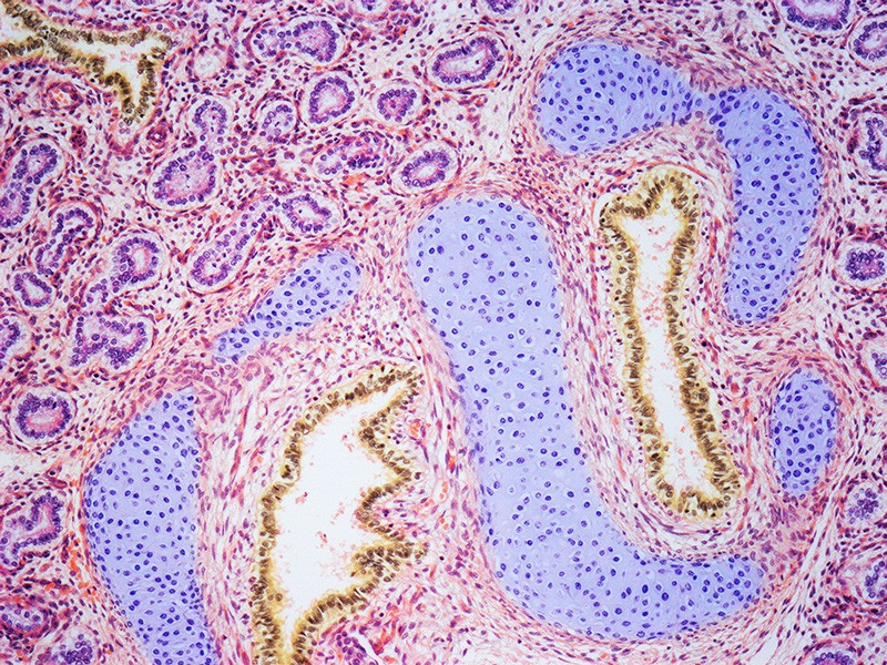 A light micrograph of a section from a human fetal lung.