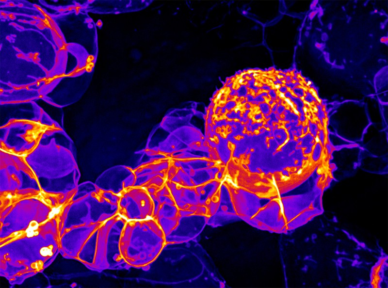 Micrograph of cells picked out in bright yellow, red and purple.