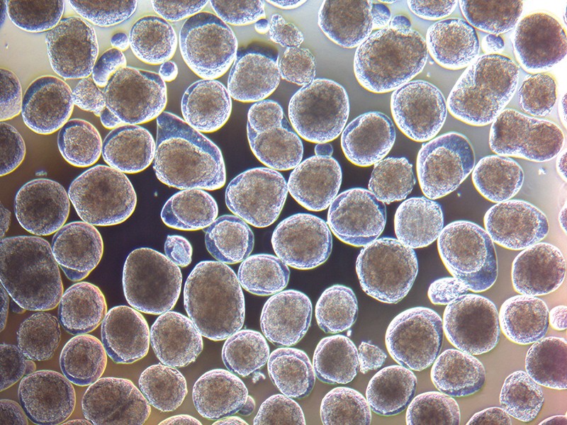 Islet cells derived from encapsulated stem cells