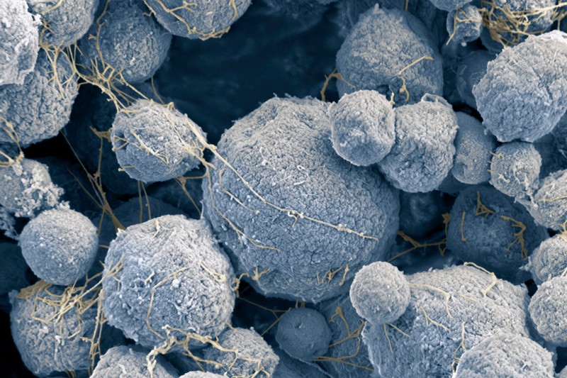 Coloured scanning electron micrograph of Methanosarcina mazei archaea have the appearance of irregular round furry balls