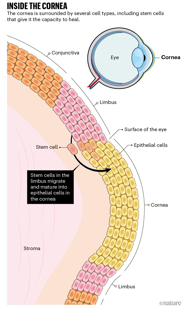 Inside the cornea: graphic showing how stem cells in the limbus migrate and mature into epithelial cells in the cornea