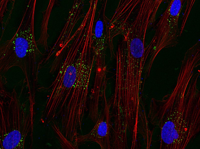 Microscope image showing fibroblasts (as red lines) with their nuclei (as blue circles) taking up oral sEVs (as green dots)