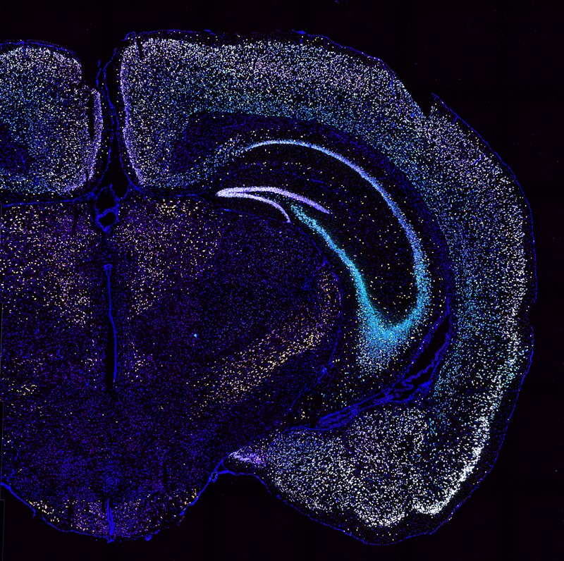 Different genes in a mouse brain slice are imaged in different colours using the BARseq2 technique