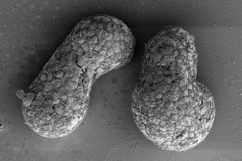 Scanning electron micrograph of two human gastruloids