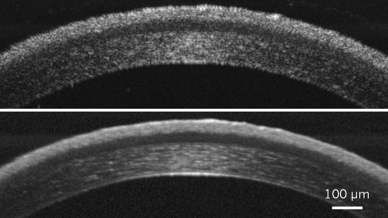 Scans of a mouse cornea get sharper by using improved optical coherence tomography