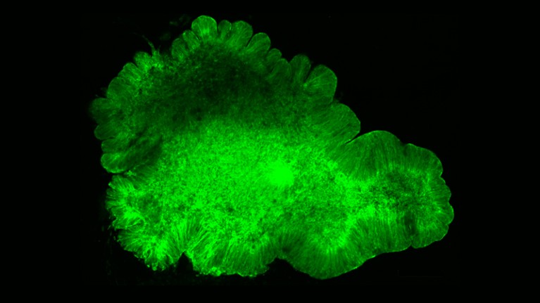 This miniature ‘brain’ was grown from human embryonic stem cells.