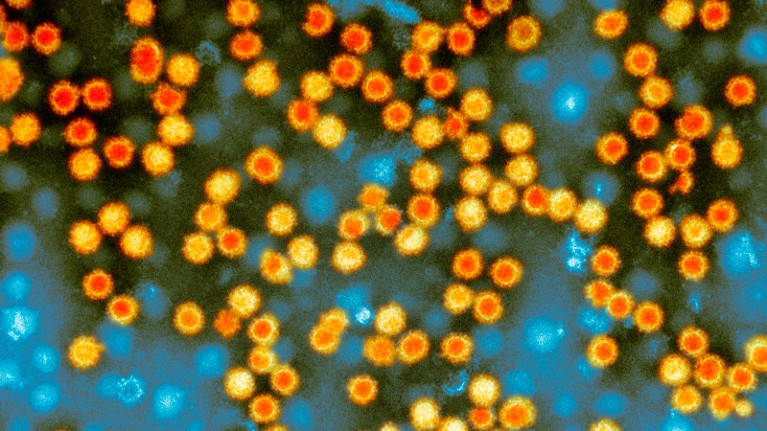 Coloured transmission electron micrograph of norovirus particles