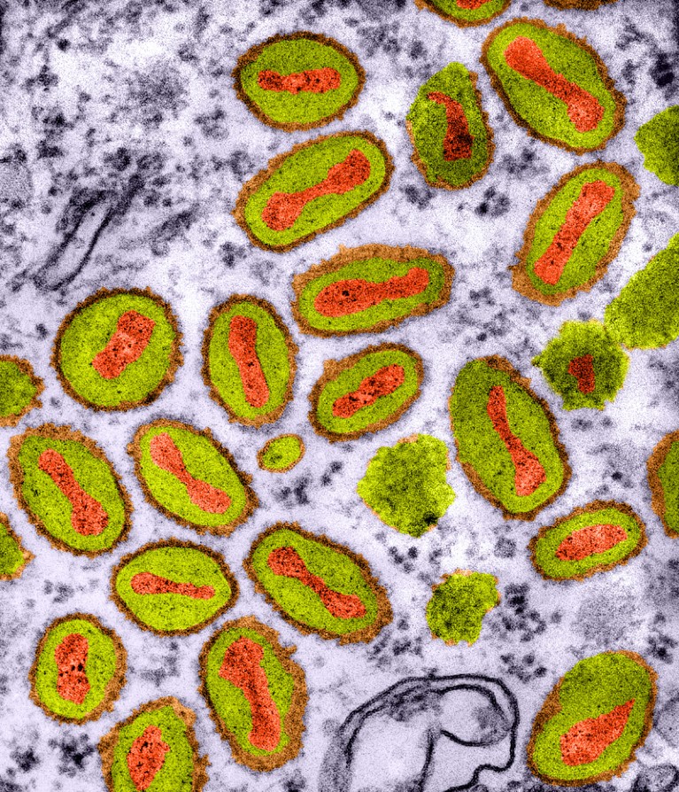 Vaccinia virus particles (red and green)