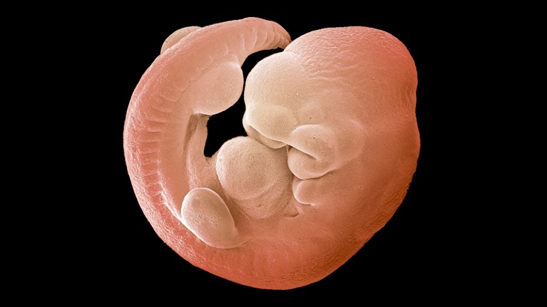 Coloured scanning electron micrograph of a 17-day-old mouse foetus