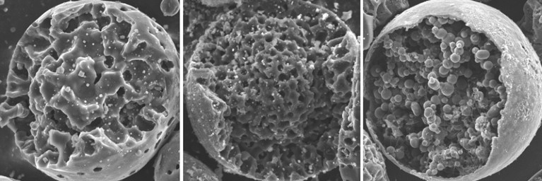 Scanning electron micrographs of mesoporous carbon microspheres