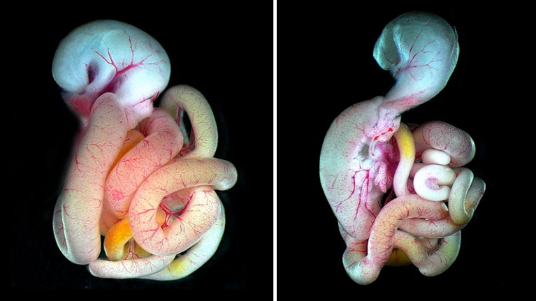 Comparison of normal (left) and mutant (right) gut configurations in mouse embryo