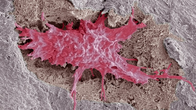 Osteocyte bone cell surrounded by bone tissue