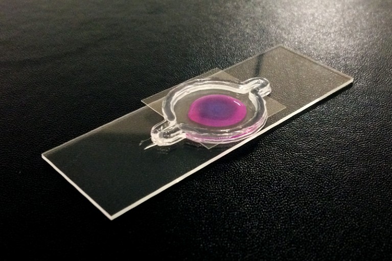 A bioprinted glioblastoma-on-a-chip