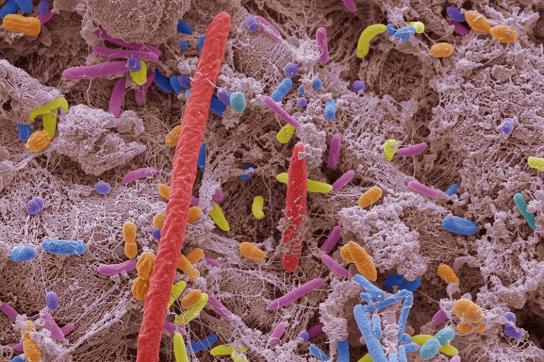 Coloured scanning electron micrograph of mixed oral bacteria.