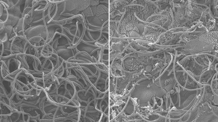 Gut-innervating neurons (LEFT) and small intestine Peyer’s patches (RIGHT).
