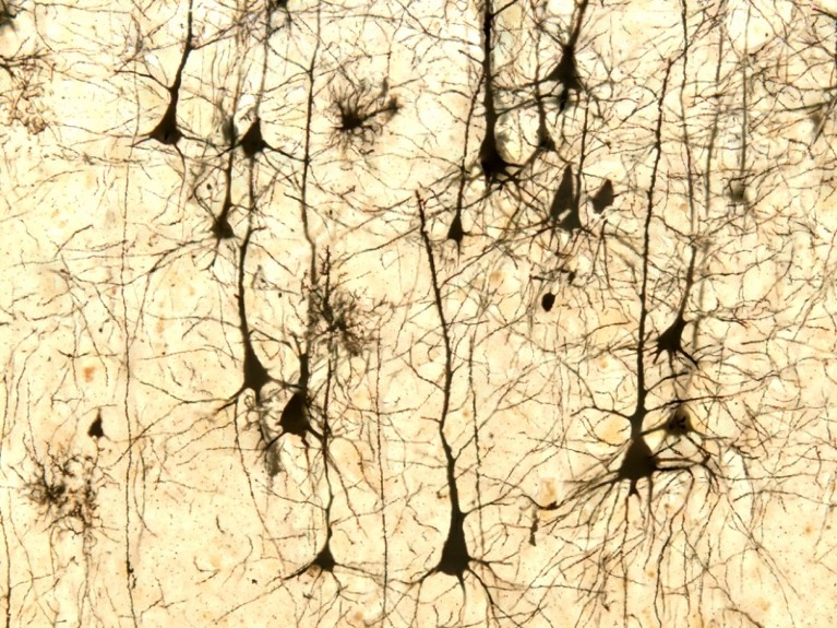 Light micrograph of pyramidal neurons of the cerebral cortex stained with Golgi silver chromate.