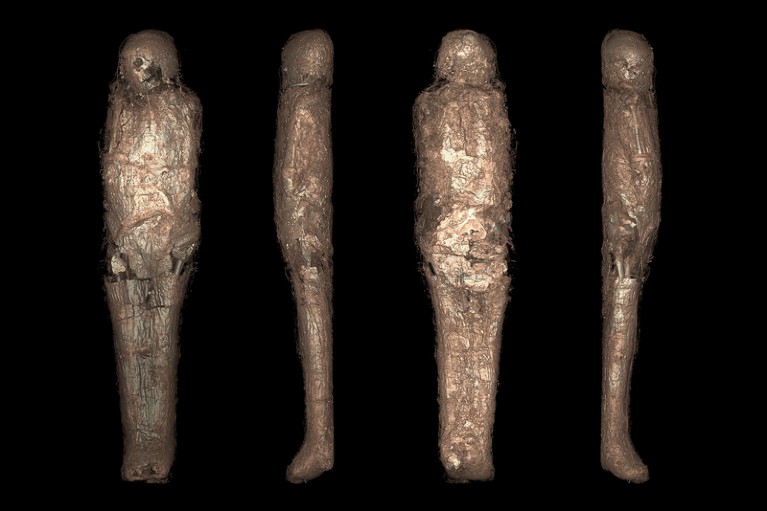 3D-rendered CT images of mummified individual