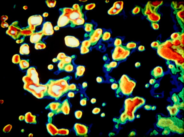 False-colour scanning transmission electron micrograph of uranium atoms