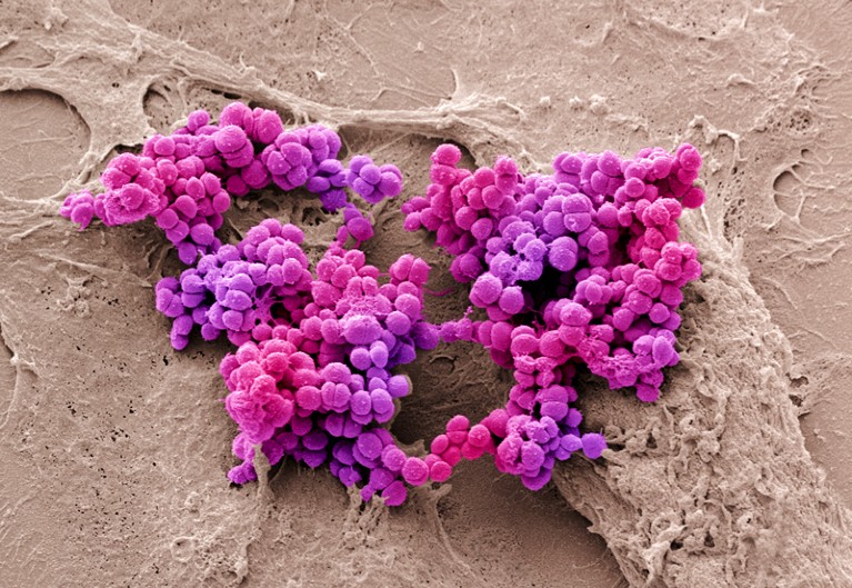 Coloured scanning electron micrograph of Staphylococcus aureus bacteria on cultured human skin cells.