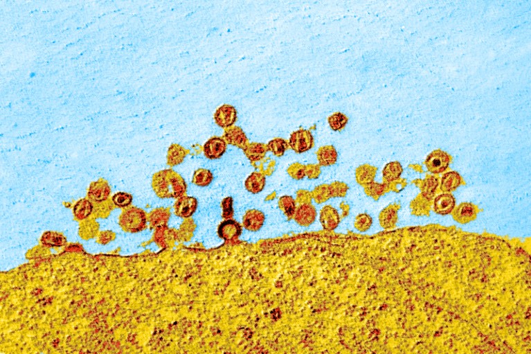 Coloured transmission electron micrograph of Simian HIV particles