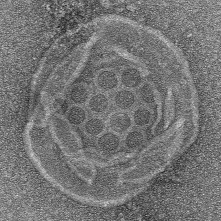 Negative stain electron microscopy of Runella gasdermin pores in DOPC liposomes