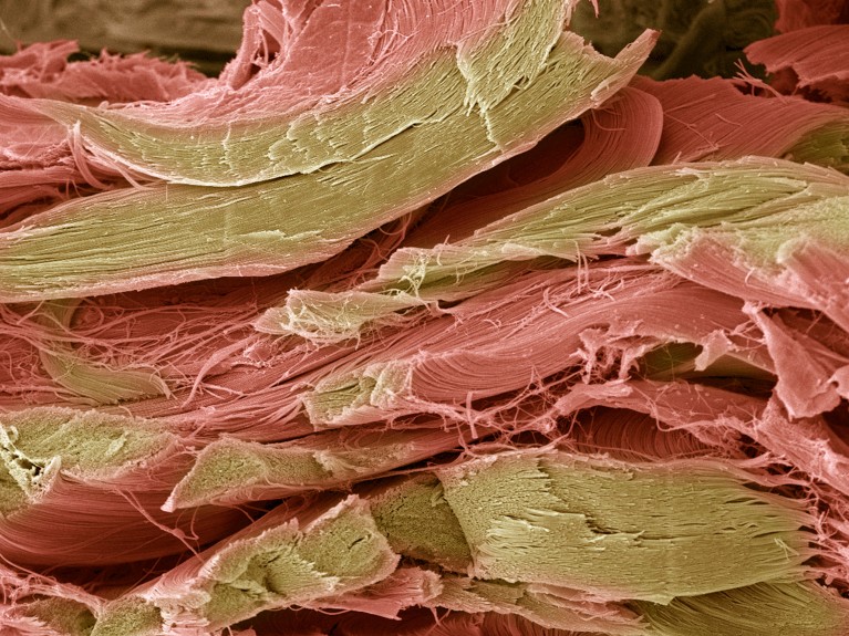 Coloured freeze-fracture scanning electron micrograph of tendon fibres.