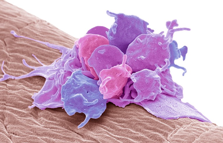 Activated platelets. Coloured scanning electron micrograph (SEM) of activated platelets attached to surgical gauze.