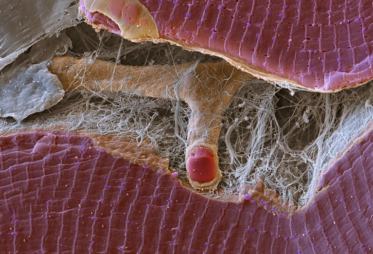 Coloured scanning electron micrograph (SEM) of a freeze-fracture through muscle tissue.