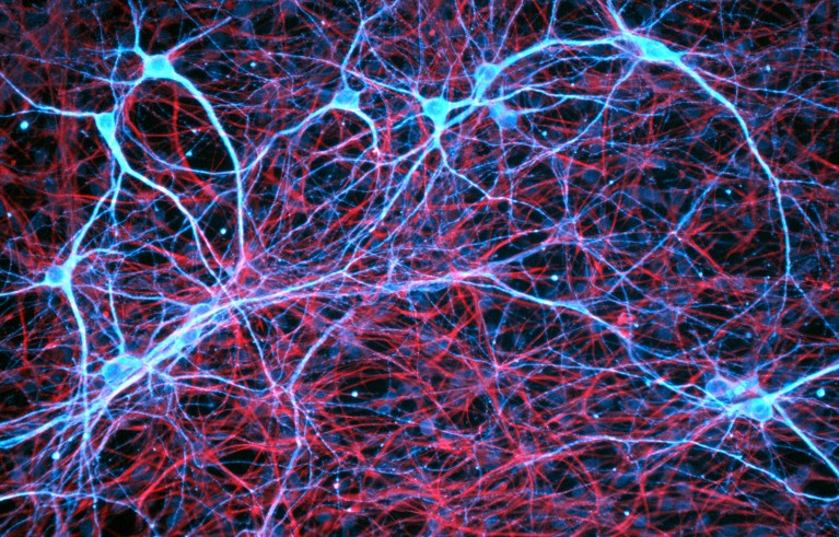 A fluorescence light micrograph of nerve and glial cells in a rat tissue sample.