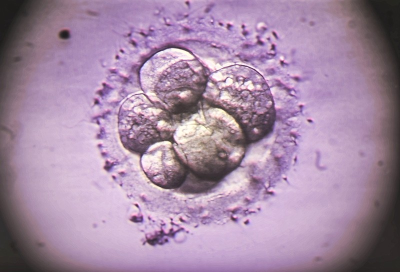 Colored light micrograph of a human embryo