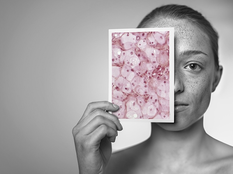 Woman holding micrograph in front of face showing skin damage face