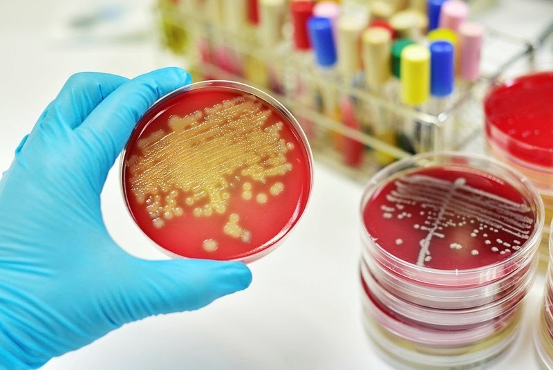 Streptococcus group A on petri dish