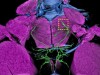肥胖症藥物或能提升睪固酮與精子品質