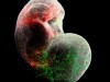 肥胖症藥物或能提升睪固酮與精子品質