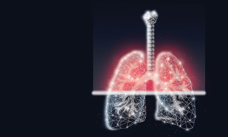 Selective activation of Wnt ameliorates idiopathic pulmonary fibrosis