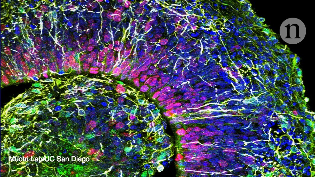 Lab-grown ‘mini brains’ produce electrical patterns that resemble those of premature babies