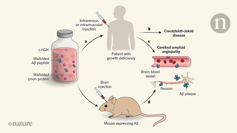 Amyloid-β ‘seeds’ in old vials of growth hormone