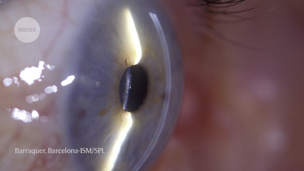 A surprise in the eye: long-lived T cells patrol the cornea